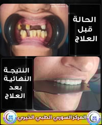 زراعة اسنان • تقويم اسنان • ضمان مدى الحياة