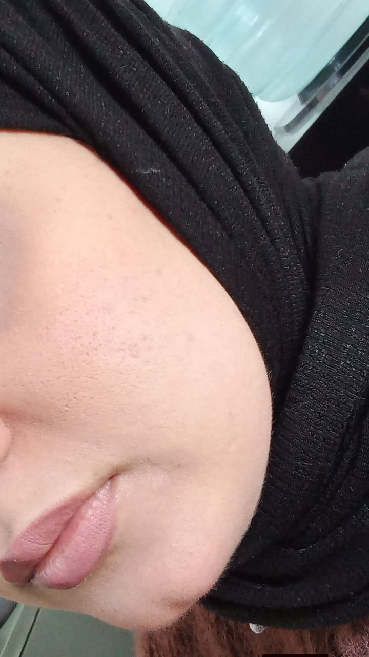 والله والله بدوون قطره مكياج صديقتي ابدد هاي تجرربه صدقتي لصابونه كولاجين  والخلطه 
يعني نتاج خررافيه خلال سبوعين بس 
غيرت بشرتها يلا بنات الي تريد وجها يصير صافي مابي تصبغات انصحها بيها  
ونبي اخر ١٠ خلطات بقن من هاي واخر ١٠ عروض 
عليهن يتاخر مواد الخلطه يلا تجيني 
استقبل بس ١٠ طلباااات بس 
@متابعين
@إشارة


**إذا كنت صاحب هذا الإعلان وتريد حذفه لأي سبب، رجاءا أرسل رسالة إلى الدعم الفني**