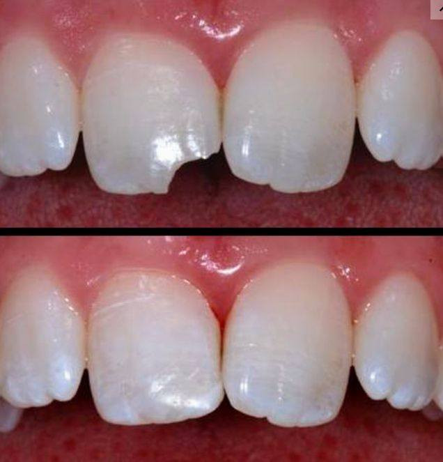 السلام عليكم اللي عندة مثل الصورة ويريد نسويلة حشوة ضوئية مجاني يتواصل واتساب *********** جامعة الهادي نهاية شارع ستين قرب كنيسة بولص وبطرس
