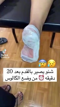 كالوس للقدم • أمريكي أصلي • ٥٠٠مل