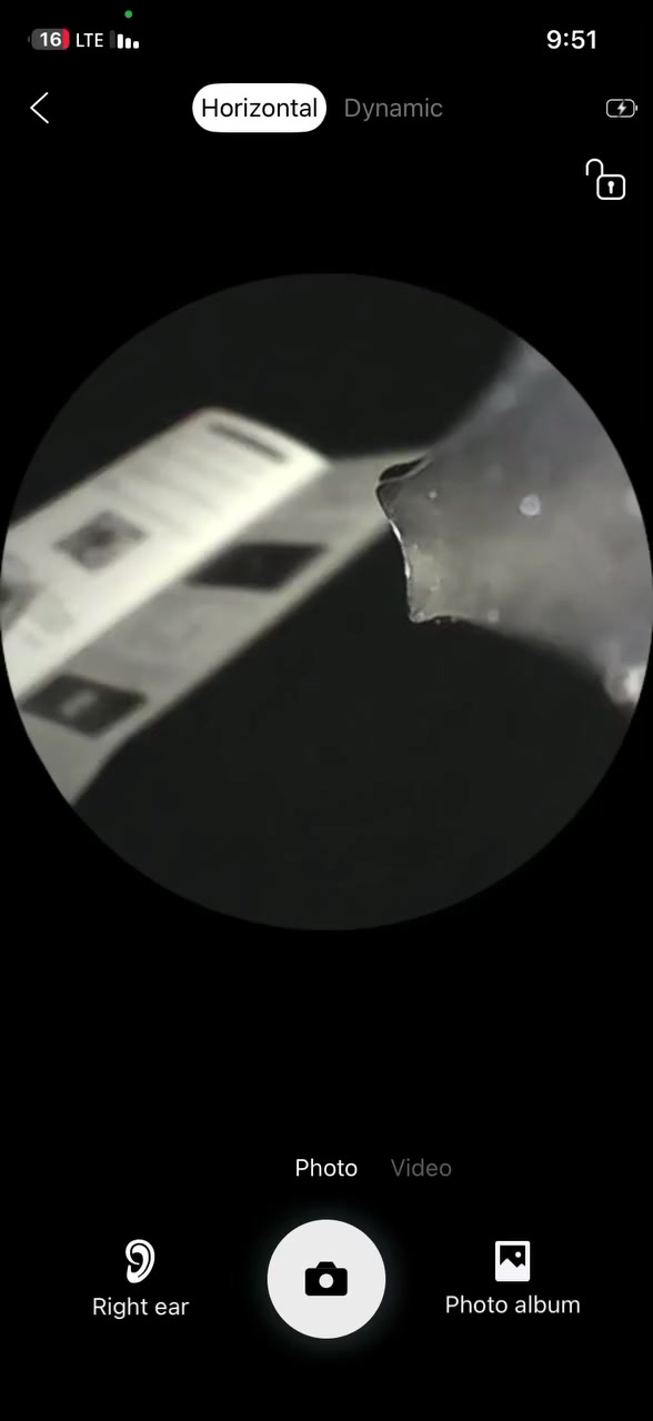 كامره تنظيف اذن والخ من الامور ب20 الف


**إذا كنت صاحب هذا الإعلان وتريد حذفه لأي سبب، رجاءا أرسل رسالة إلى الدعم الفني**