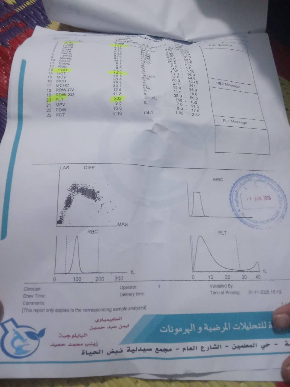 نداء إنساني عاجل.. يا أهل الغيرة والنخوة في ديالى والمقدادية (شهربان)
"مَنْ نَفَّسَ عَنْ مُؤْمِنٍ كُرْبَةً مِنْ كُرَبِ الدُّنْيَا، نَفَّسَ اللهُ عَنْهُ كُرْبَةً مِنْ كُرَبِ يَوْمِ الْقِيَامَةِ"

​إلى أصحاب القلوب الرحيمة، إلى أهلنا في المقدادية (سوق القديم ومنطقة العروبة)، يا من عُرفتم بالكرم والوقوف مع المحتاج في أحلك الظروف.

​بيننا اليوم عائلة متعففة تعيش وضعاً مأساوياً؛ امرأة صابرة، أم لـ 7 أطفال، تعاني من مرض شديد وتفتقر لأبسط مقومات العلاج. هي بحاجة ماسة لعملية (زراعة) تكلف 150 ألفاً، وهو مبلغ تعجز الجبال عن حمله فكيف بعائلة تسكن "بالإيجار" ويثقل كاهلها الديون، وزوجها لا يملك من حطام الدنيا شيئاً؟

​هذه المرة، النداء ليس مجرد كلمات، بل هو استغاثة بـ "بخت" أهل شهربان وشهامتهم. هذه المرأة هي أختكم وابنتكم، وأطفالها السبعة ينتظرون من يمسح دمعتهم ويعيد لوالدتهم عافيتها.

​لأهل المنطقة في العروبة وسوق القديم:

يمكنكم الاطلاع بأنفسكم على الحالة والتقارير الطبية للتأكد من كل التفاصيل. المصداقية هي أساس عملنا، وهدفنا هو إنقاذ هذه الروح.

​من يريد المساهمة، ولو بالقليل، أو من يعرف جهة خيرية يمكنها التكفل بالعملية، يرجى التواصل معنا فوراً.

​"والله في عون العبد ما كان العبد في عون أخيه"

​أرجو من الجميع "مشاركة" (Share) للمنشور ليصل إلى أكبر عدد من المحسنين.. لعلّ الله يجعل شفاءها على يد أحدكم.

​للتواصل والاستفسار: [***********]

ماستر (6345935594)

​#المقدادية #ديالى #شهربان #منطقة_العروبة #عمل_خيري #نداء_إنساني
