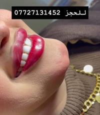 فيلر شفاه • خلايا جذعية • عيادات الرحمة