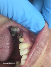 احجز موعدك اليوم وخلي ابتسامتك تحجي عنك بكل أناقة 😁✨ ☎️ للحجز والاستفس...