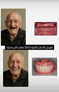 الزبير • عيادة كلية طب الأسنان • حشوات بيضاء