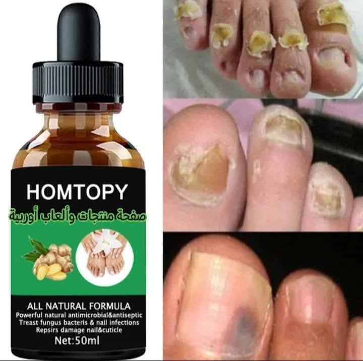 أتوفر سيروم HOMTOPY الاصلي سيروم ال 7 أيام صار تكدرون تتخلصون من الفطريات والبكتيريا وعدم اطالة الاضافر بشكل صحي وبدون مشاكل  وبمكونات طبيعية100% خلال اسبوع فقط المنتج اصلي لا نتعامل بالمنتجات المقلدة

✅علاج فطريات الأظافر "

✅علاج الأظافر والبكتيريا والالتهابات 

✅علاج الأظافر التالفة والبشرة المحيطة بالأظافر.

✅تطويل الاضافر بشكل نظيف  

المكونات: طبيعية بالكامل، وتعمل كمضاد للميكروبات ومطهر.
الوزن الصافي: 50 جرام.

للحجز والاستفسار راسلوا الصفحة لطفا
تتوفر خدمة توصيل لجميع المناطق والمحافظات


**إذا كنت صاحب هذا الإعلان وتريد حذفه لأي سبب، رجاءا أرسل رسالة إلى الدعم الفني**
