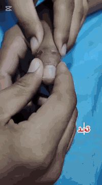 #نعتمد في عملنا على أحدث الدراسات في التخصص .. نواكب ماهو جديد 

✨🌿 أهلاً وسهلاً بكم في عيادتنا #عيادة_العامريه_للعلاج_الطبيعي_والتأهيل_الطبي  🌿✨

المعالج الاختصاص/ حمزه محمد  
يوجد كادر نسائي 
ايام الدوام : يوميا ماعدا الجمعه 
📍 العنوان: [ عامرية الصمود - مجمع النور الطبي ] 
📞 للحجز والاستفسار: [  ***********  ]
