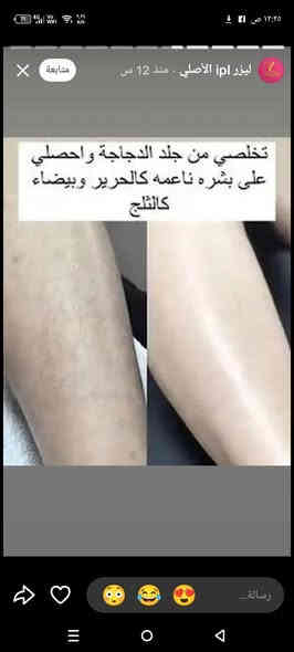 مرحبا بنات توفر اليزر المنزلي الاصلي ipl ابو 5مليون ضربة للحجز والاستفسار الاتصال على الرقم ***********
