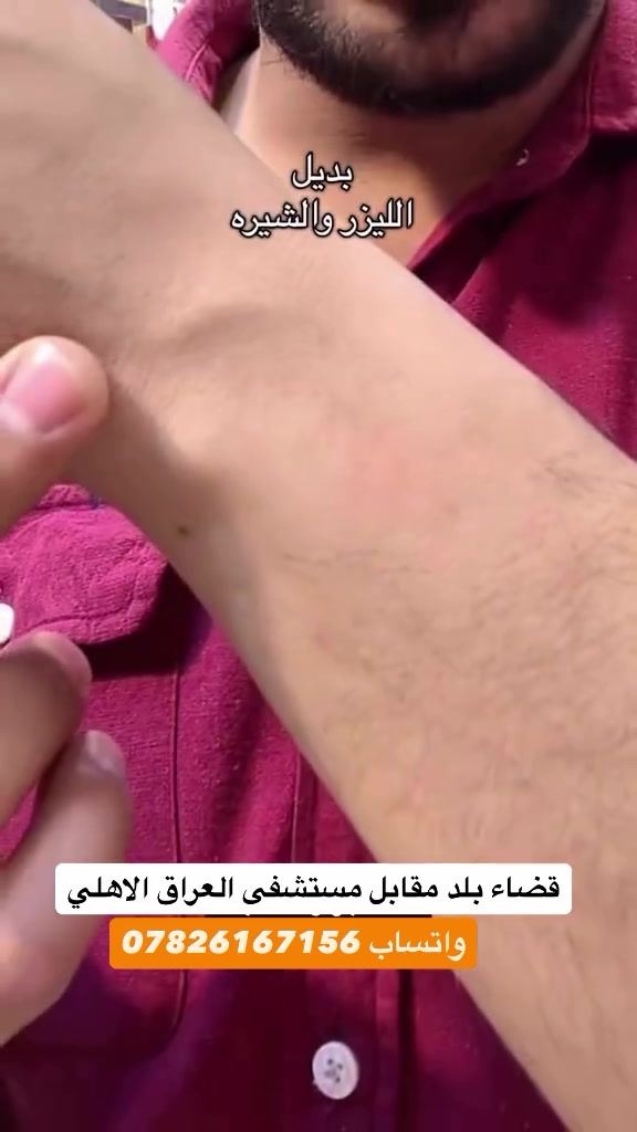 على بركة الله 
وجبه جديده
بودره مزيل للشعر 
امنه وطبيه  وسهلة لاستخدام
قضاء بلد مقابل مستشفى العراق الدولي الاهلي
واتساب ***********
