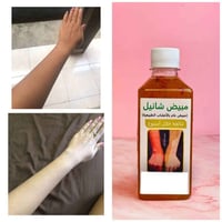 شانيل • تبييض • كربلاء