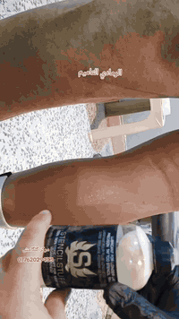 مركز گلگامش • وشم وازالة • الرمادي التاميم