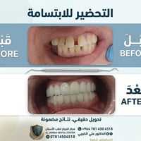عيادة اسنان • خصومات • الحر/القادسيه