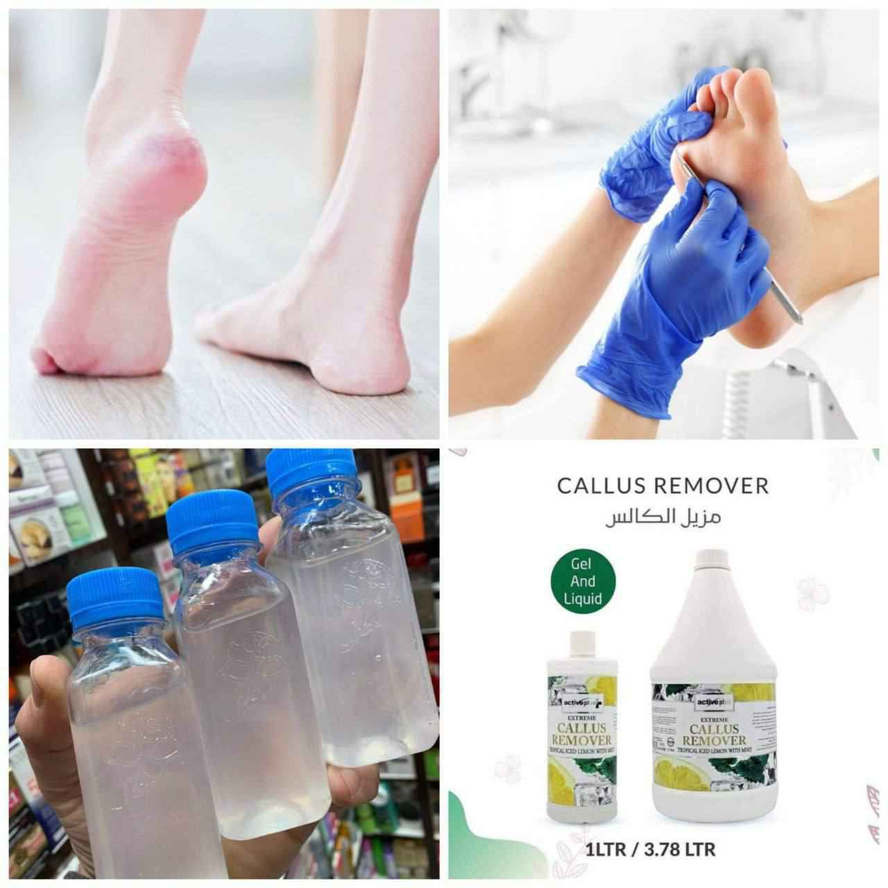 كالوس لازالة الجلد الميت و تشققات القدم
CALLUS REMOVER
ميحتاج تروحين مركز تجميل او صالون توفر منتج ( كالوس ) للقدم تگدرين تشتغليه بالبيت وبكل سهوله ♥️
وضيفته يشيل الجلد الخشن الي بالكعب خلال دقائق 👍✋
مزيل مسامير القدم - قولي وداعًا لتصلب الجلد والجلد الميت. مثل امتلاك باديكير احترافي بدون تكلفة عالية.
القضاء على الناجم في المنزل! - مزيل الجلد الميت هذا للقدمين يعمل خلال 3 إلى 5 دقائق! ببساطة انقع قدميك في حوض الاستحمام أو في حوض قدم، انتظر ثم استخدم أداة تنظيف القدم المفضلة لديك أو حجر خفاف القدم لإزالة مسامير القدم بلطف.
استخدمه مع مقشِّر قدمك المفضل - لا يقتصر على إزالة مسامير القدم فحسب، بل يجعل قدميك ناعمتين وناعمتين للطفل.

كالوس تقشير اقدام  فوري وفعلي للاقدام 
  طريقة الاستخدام:
   تغسل الاقدام بالماء  والصابون وتنقع في ماء ساخن. لمدة 5 دقائق  ومن  ثم تجفف  وتوضع قطرات من الكالوس على الجلد الخشن والتشققات وتدلك بواسطة شريحة قطنية وتترك لمدة 3 دقائق فقط وبعدها يستعمل   حجر او مبرد لازالة الجلد الميت ملاحظة يفضل استخدام قفازات بلاستيكية اثناء الاستخدام
المنشأ اماراتي اصلي 💯   
🚘 يوجد خدمة توصيل لجميع محافضات العراق بغداد, العراق


**إذا كنت صاحب هذا الإعلان وتريد حذفه لأي سبب، رجاءا أرسل رسالة إلى الدعم الفني**