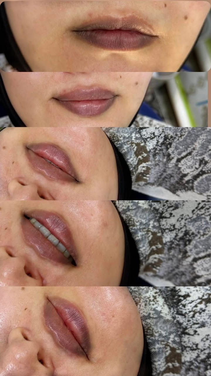 اليوم مسابقتنا غييير ❤️‍🔥❤️
صاحبة الصورة الي تحصل اكثر عدد من اللايكات 
تفوز ويانا بجلسة نضارة الريفتا مجانية❤️
شوفو الصور وسوو لايك
وسوو تاك لصديقاتكم يفوزوكم😍
كل فترة اختار كم صورة نسوي عليهم مسابقة حتى يفوزون مراجعاتنا الدائمات❤️❤️❤️😍


**إذا كنت صاحب هذا الإعلان وتريد حذفه لأي سبب، رجاءا أرسل رسالة إلى الدعم الفني**