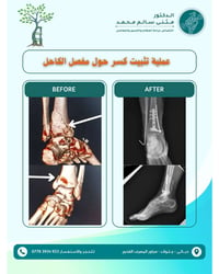 طبيب عظام • تثبيت كسور • ديالى جلولاء