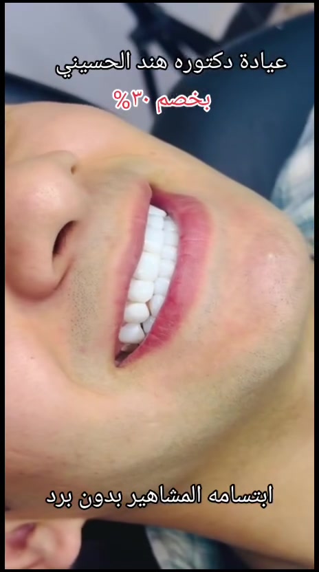 مراجعينا العيد هل مره غيررر 😍🔥
عروض قوية بقسم التجميل والأسنان بعيادة د. هند الحسيني ✨
💉 فلر
💉 بوتوكس
✨ بشرة زجاجية ولمعة تخبل
👑 تغير شامل يطلعج غير شكل
😁 تنظيف وتبييض أسنان
✨ ابتسامة هوليود
وكل هذا بأسعار وعروض العيد 🔥
شغل ناعم وفخم ونتايج تفتح النفس 🤍
الامين الثانيه/تقاطع الزهور/شارع المهداوي/مقابل عيادة النبأ
***********
