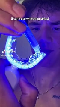 جهاز تبيض الاسنان جودة عالية بأسعار مناسبة 💥 مكتب سنتر المعامل للمستلز...