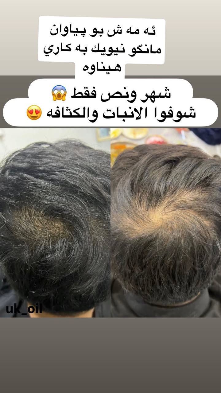 كي حه زه كات قژيكي جوانو پري هه بيت  باشترين زه يت


**إذا كنت صاحب هذا الإعلان وتريد حذفه لأي سبب، رجاءا أرسل رسالة إلى الدعم الفني**