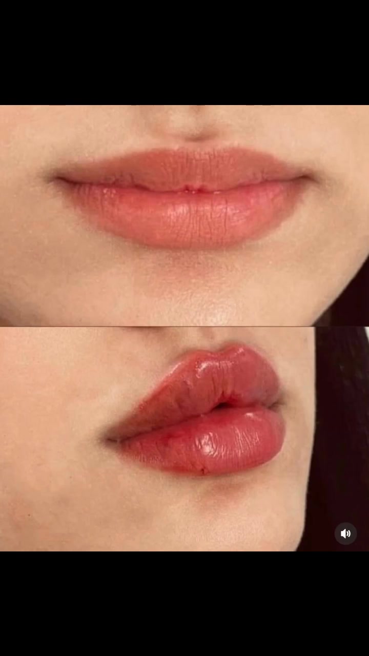 تتواجد دكتورة التجميل اليوم مع عروض مميزة ✨

💋 فلر شفه فقط ٥٥ ألف
💉 بوتوكس ٦٥ ألف
🌸 جلسة علاج التصبغات ٢٥ ألف
🩺 جلسة علاج تساقط الشعر ٢٥ ألف
✨ بلازما لنظارة الوجه ١٥ ألف

📍 العنوان:
مجمع المحموديه الطبي الخيري
المحموديه – شارع قائمقام
قرب جامع المحموديه الكبير

📞 رقم الحجز:
***********
