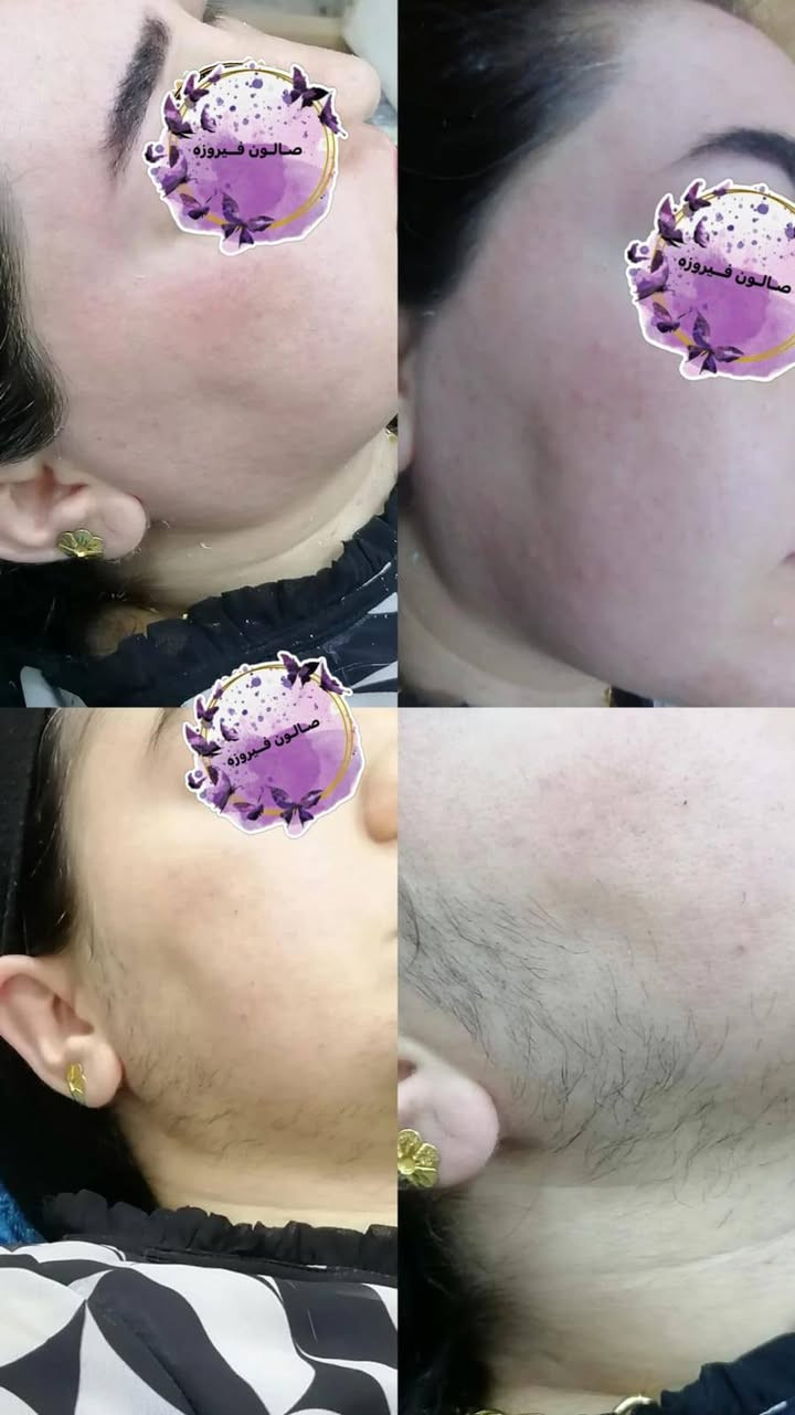 صالون فيروزا يفتتح طيله ايام القادمه وبأنسب الاسعار
الموقع هيت حي الجمعيه
للاستفسار عبره الرقم أو تواصل خاص  
***********
