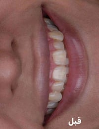 عيادة سومر • تجميل اسنان • دكتور موسى