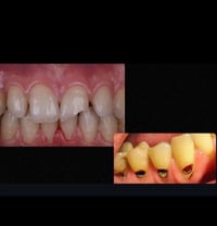 كربلاء حي الحر • علاج مجاني • تسوس سن امامي