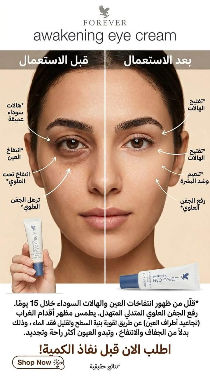 وداعاً للتعب والهالات.. وخلي عيونج تنبض بالحياة! 🌟
​لكل البنات اللي يعانن من السهر، التعب، والهالات المزعجة.. جبنالكم الحل السحري والنهائي من شركة فوريفير ليفينج العالمية! 💆‍♀️✨
​👁️ كريم awakening eye cream (كريم إيقاظ العين) 👁️
​هذا الكريم مو مجرد مرطب عادي، هذا معجزة صغيرة راح تغير إطلالتج بـ 15 يوم بس! 😉👇
​💫 شنو اللي راح يسويه لعيونج؟
​🔴 يقلل بشكل ملحوظ من الهالات السوداء والانتفاخات تحت العين.
​🔴 يرفع الجفن العلوي المترهل وينطي لعيونج نظرة واسعة ومصحصحة.
​🔴 يطمس تجاعيد أطراف العين (أقدام الغراب) ويقوي بنية البشرة حول العين.
​🔴 يرطب بعمق ويحمي المنطقة من الجفاف حتى تبقين دايماً بشكل أصغر وأكثر حيوية.
​💰 التفاصيل والطلب:
​🚨 الكمية جدًا محدودة! لا تترددين واحجزي قطعتج هسة قبل ما تخلص الكمية وتفوتج الفرصة! 🛒💨
​💌 للطلب أو الاستفسار، راسلينا على الخاص مباشرةً 💌#عناية_بالشعر #بغداد_بصرة_موصل_الكويت_الخليج_دبي_الامارات_السعودية_العراق_حلوات_لبنان_سوريا_فلسطين #عنايه_شخصيه_للجسم_جل_استحمام_كريمات_تفتيح_المناطق_الحساسه_ترطيب👌🏻👌🏻👌🏻❤️❤️❤️ #عنايةبالبشرة #عناية_أنثوية


**إذا كنت صاحب هذا الإعلان وتريد حذفه لأي سبب، رجاءا أرسل رسالة إلى الدعم الفني**