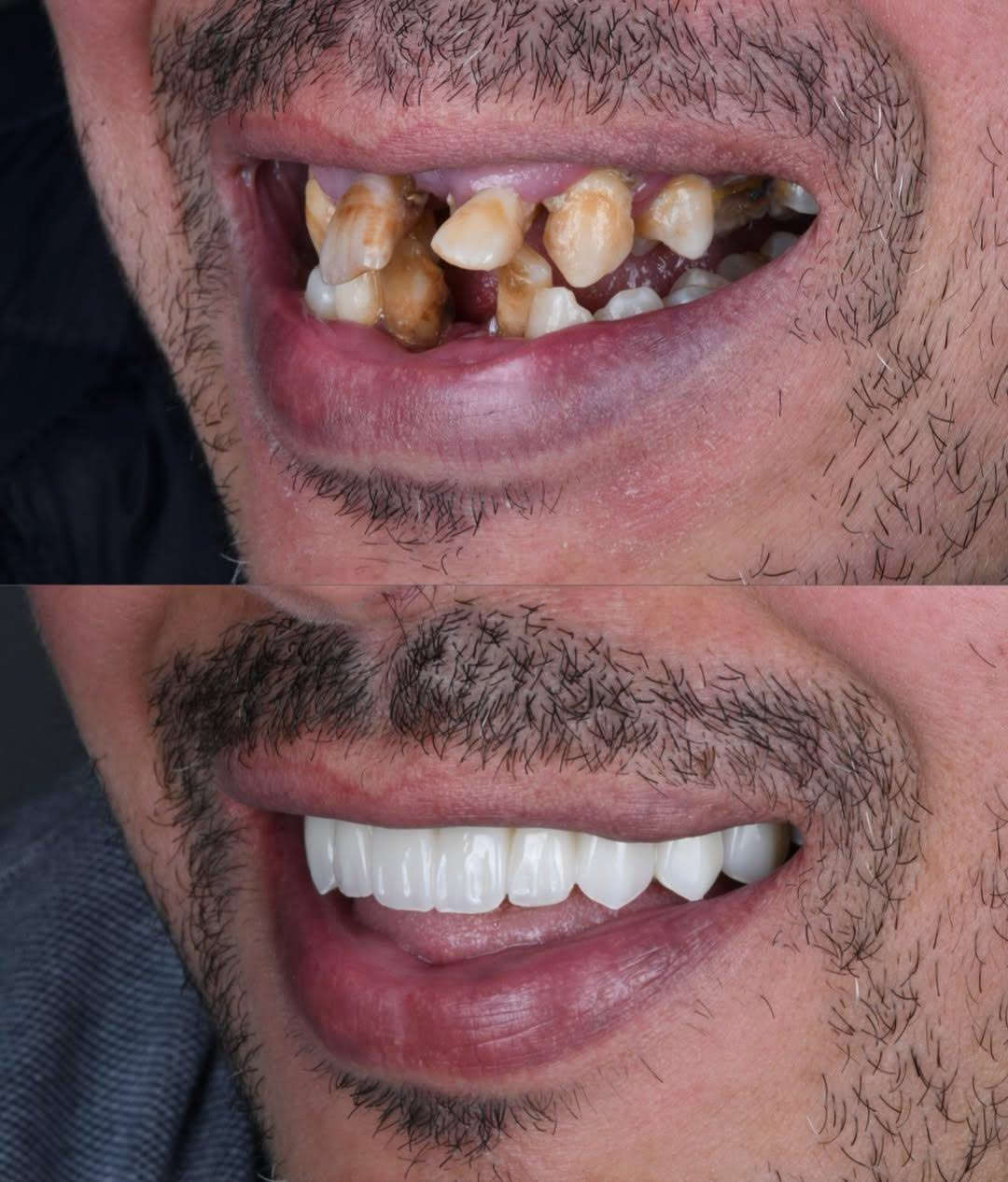 في مركز ماسة الحسينية التخصصي لطب وجراحة الفم والأسنان

دلل نفسك بابتسامة تليق بك.. ابتسامة المشاهير في مركز 
ماسة 👑

متوفر أقساط منصة الرافدين ومنصة الرشيد لتسهيل الدفع على الجميع.

🎁 (الفحص والاستشارة مجانية تماماً).
📲 الحجز مفتوح هسة عبر الواتساب، راسلنا مباشرة وخلي الباقي علينا:
📞 ***********
📍 العنوان: بغداد - الحسينية - شارع عشرين - مجاور السوق الأول
