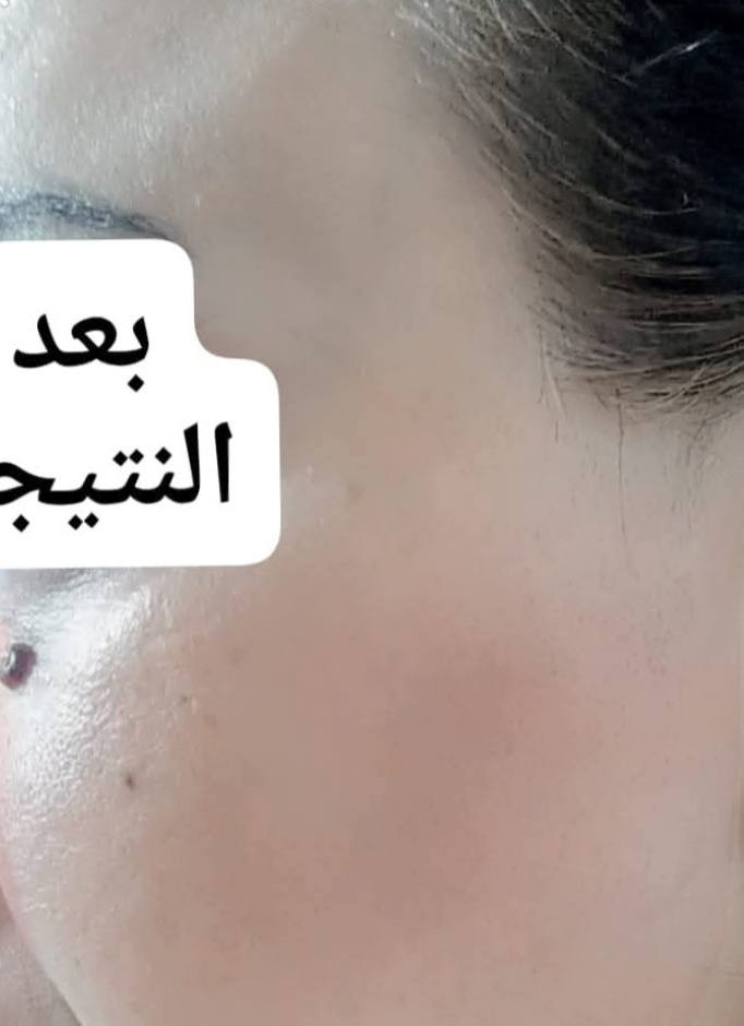 ونرجع وياكم وي بكج البشره 
كريم دلوش 
وابرة العنبر 
وماسك العنبر 
ومجموعه متكامله زبونتي تعاني من سواد وحبوب ناعمه شوفوا قبل وبعد
استمرت ويانه وهاي نتائج فعلا بشرتها صارت تجننن


**إذا كنت صاحب هذا الإعلان وتريد حذفه لأي سبب، رجاءا أرسل رسالة إلى الدعم الفني**