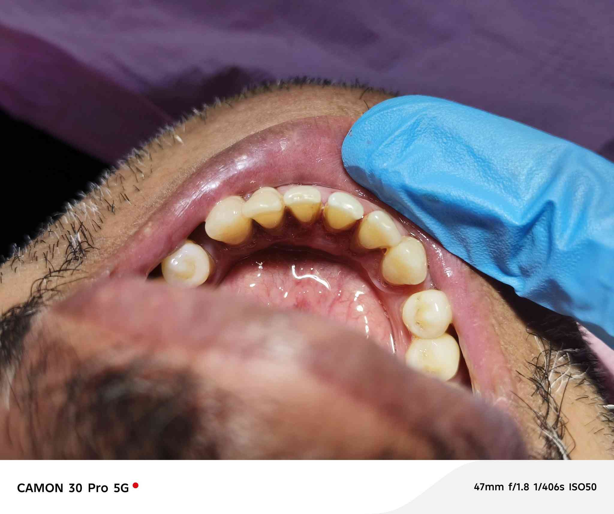 حياكم الله اخوان
علاج اسنان مجاني يشمل تنظيف وحشوات وقلع 
للاستفسار والحجز خاص او اتصل *********** 
عنوان العيادة شارع ٤٠ مجاور جامع ابو خمرة واهلا وسهلا بكم
