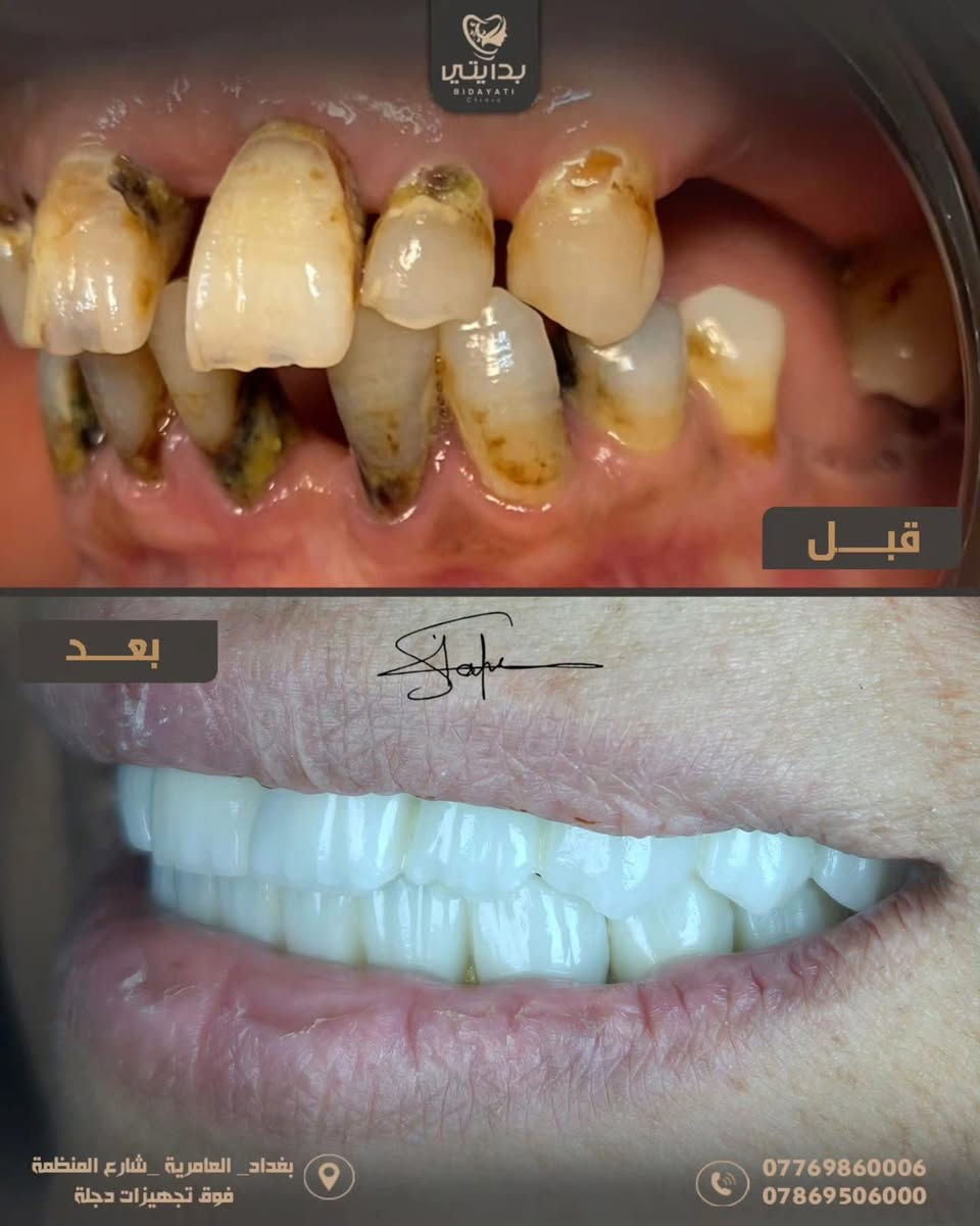 ⁨ ⁨ ⁨ عيادة بدايتي ✨🤎
📍 العامرية – شارع المنظمة – فوق مستلزمات دجلة
📞 *********** – ***********⁩⁩⁩

