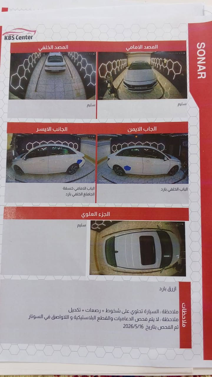 مكان السياره كربلاء للستفسار ‏‪***********‬‏
السلام عليكم هواندي الانترا موديل السعر المطلوب175 وبيها مجال 2024 مكفوله ماعدا بارد موضح بل سنوار السياره فول مواصفات ماشيه 40الف فقط
