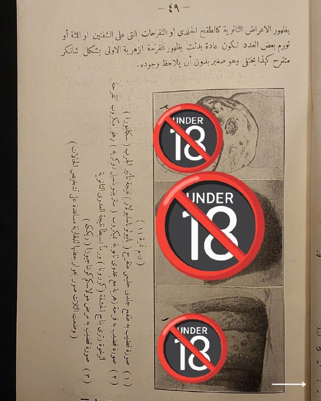 "مرجع طبي تراثي نادر في علم الأمراض السريرية والعلاجات الكلاسيكية!"
🌍
📜
🩺
🩸
📘
(كتاب الأمراض التناسلية وعلاجها وطرق الوقاية منها)
تأليف: الدكتور فخري (طبيب الجلد والأمراض التناسلية).
⚜️
📚
ناشر الطبعة: المطبعة العصرية ومكتبة الخليل لصاحبها خليل الخليلي - مصر
🇪🇬
.
✨
عن هذه النسخة التراثية:
سنة الطبع: 1960-1970
الحالة: ممتازة
✅
الموضوع:
كتاب طبي تاريخي وتخصصي رصين يستعرض بدقة علمية كلاسيكية منظومة الأمراض التناسلية والجلدية الشائعة وطرق تشخيصها السريري وعلاجاتها الدوائية والوقائية المعتمدة في القرن الماضي، يهم جداً أطباء الجلدية والتناسلية، طلاب كليات الطب والصيدلة، الباحثين في تاريخ العلوم الطبية، وهواة اقتناء المخطوطات والمراجع الطبية التراثية النادرة.
للحجز
🔻
:
البوت:
@PH_900bot
أو واتساب: ***********
