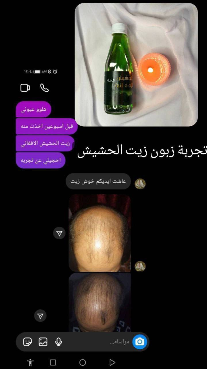 🦋:هـلـو عـمري 🦋 شعرج تعبان ومتقصف خفيف وديتساقط عندي الحل الج زيت الحشيش الافغاني راح يحل جمع المشاكل الي تعانين منهاا تاخذينةة ومتندمين 🥹
❤️وسعرةة بـ25 الف بسس 

ولتوصيل مجاني @إشارة 
وهديه وي الطلب من البيج


**إذا كنت صاحب هذا الإعلان وتريد حذفه لأي سبب، رجاءا أرسل رسالة إلى الدعم الفني**