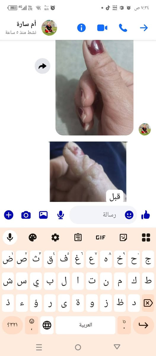 للاستفسار خاص


**إذا كنت صاحب هذا الإعلان وتريد حذفه لأي سبب، رجاءا أرسل رسالة إلى الدعم الفني**