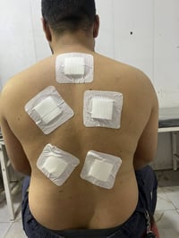 حجامة نبوية • بإشراف مختص • الكرغوليه سايد