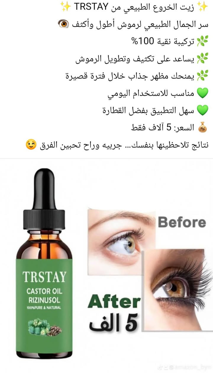 ب3 الاف فقط


**إذا كنت صاحب هذا الإعلان وتريد حذفه لأي سبب، رجاءا أرسل رسالة إلى الدعم الفني**