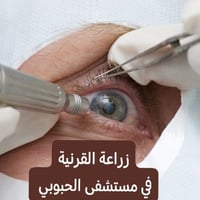 زراعة قرنية • استشارة عيون • مستشفى الحبوبي
