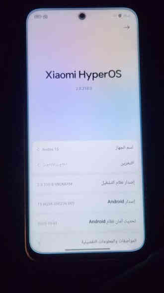 redmi 15
١ رۆژ ئیشی کرددوە
قوفلی ١٦٥ هەزار
حساب کە خۆت هەڵی دەپچری
ڕام ٨ + ٨
٢٥٦
شاشە ١٤٤ هێرتز
پاتری ٧٠٠٠
٣٣ وات
زەمانی ئایتی لۆبی ١٨ مانگ 
ناونیشان هەولێر 
گەیاندن هەیە 
*********** أربيل
