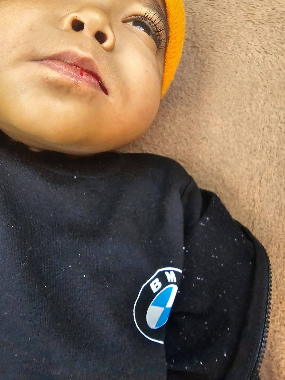 بسم الله الرحمن الرحيم
(وَمَا تُقَدِّمُوا لِأَنْفُسِكُمْ مِنْ خَيْرٍ تَجِدُوهُ عِنْدَ اللهِ إِنَّ اللهَ بِمَا تَعْمَلُونَ بَصِيرٌ)

مناشده انسانيه طارئه لانقاذ حياة الطفل المريض (يحيى يونس) الذي يعاني من مرض (تليف الكبد) منذ ولادته وحالته الصحيه تتدهور ويمر بآلام شديدة  قرر الاطباء ضرورة أجراء عمليه جراحيه عاجله لزراعة الكبد وتكلفه العمليه تبلغ (60 مليون) وهو مبلغ فوق قدرتي الماديه نناشد اهل الخير والقلوب الرحيمه والجهات المختصة الوقوف معنا لانقاذ حياه الطفل

رقم الماستر      7138533802
رقم الهاتف       ***********
