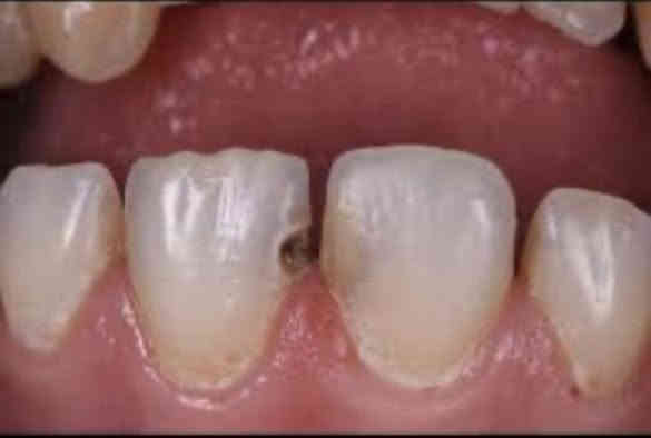 السلام عليكم 
الي محتاج (يراسلني)
قلع 
حشوات تجميليه
علاج اسنان الاطفال 
تركيب طقم جزئي .كامل  متحرك
وتنضيف اسنان 
الشغل (مجاني)
عيادات جامعه العميد كربلاء
***********
