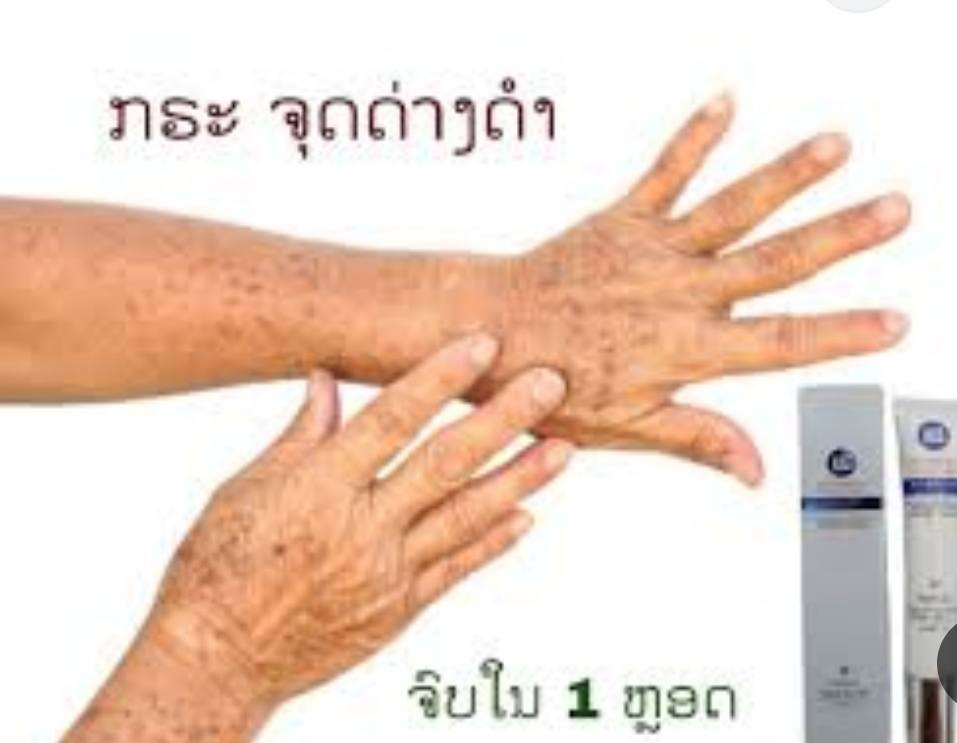 كريم تبيض البشره 
للكلف وتصبغات فعال
لوسمحت اقرا ترجمه داخل صوره 👇👇👇
تمتعي ببشرة صافيه مشرقه
توصيل لجميع محافظات العراق


**إذا كنت صاحب هذا الإعلان وتريد حذفه لأي سبب، رجاءا أرسل رسالة إلى الدعم الفني**