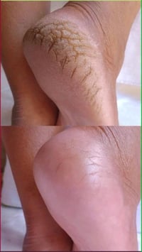 العناية بالقدمين • العناية باليدين • جل إزالة الكالوس • كريم قدم • إزا...