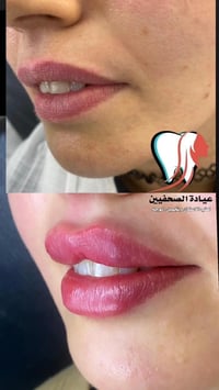 📍العنوان البلديات / الصحفيين على يمين افران ومعجنات عسل ( مقابل الساحا...