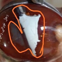 خاتم • داووي • قديم جدا