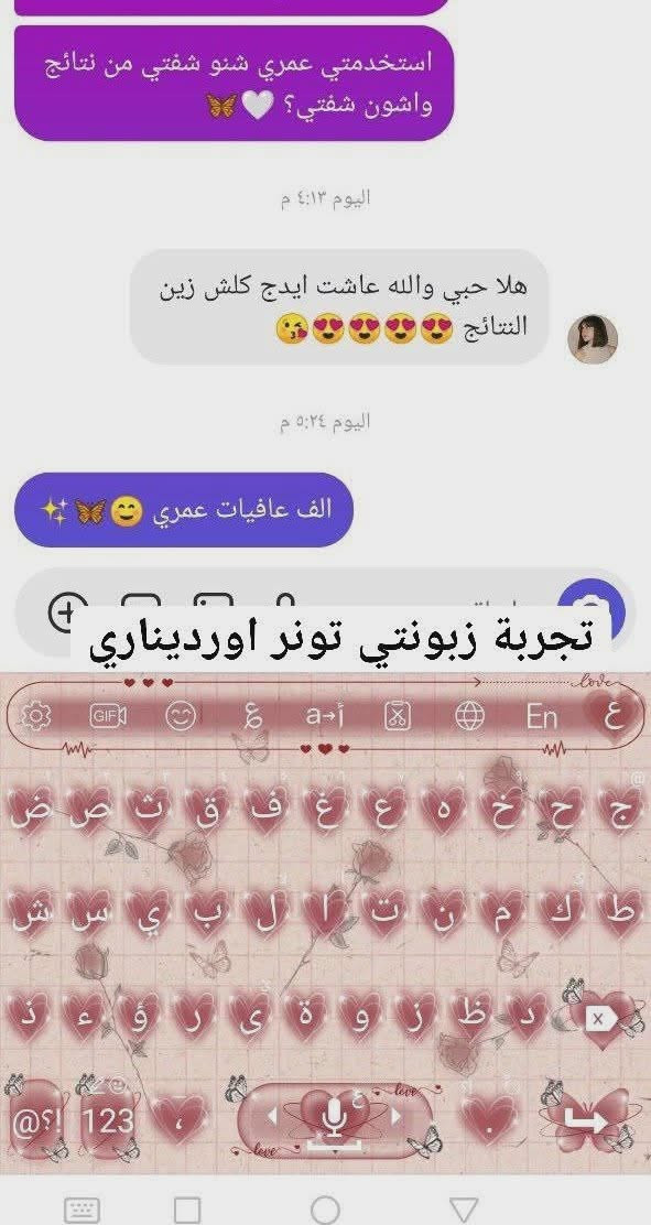 إشارة إلى الأصدقاء 󱢏تونر ذا اوردنري – جلايكولك أسيد 7% من ذا اوردنري The ordinary 😌😌
🦋 تقشير لطيف + إزالة الجلد الميت
🦋 يحسّن الخطوط والتجاعيد ويحفّز الكولاجين
🦋 يعالج الحبوب + يفتح ويوحّد لون البشرة
🦋 يصغّر المسام / للبشرة والجسم [ غير مناسب❌  للبشرة الحساسة ] 
🇺🇸 حجم 240 مل – أصلي
🎁 ويه كل طلب  علبة قطن هدية

 #اكسبلور_2020 #اكسبلورexplore #viral #اكسبلور #شعر_حب #جسم_مثالي #مناطق_حساسه #بشرة_صافية #سيروم #مكياج #منتجات_عناية


**إذا كنت صاحب هذا الإعلان وتريد حذفه لأي سبب، رجاءا أرسل رسالة إلى الدعم الفني**