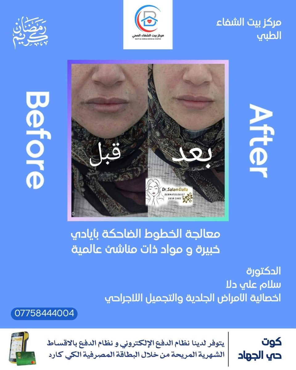 أهلاً وسهلاً بكم في مركزنا 💯مركز بيت الشفاء الطبي 💯
 في عيادة الدكتورة سلام علي دلا 🧑‍⚕️  المختصة في الأمراض الجلدية والتجميل والليزر 💯💯

. مختصة في الأمراض الجلدية والتجميل والليزر 
.طبيبة جلدية وتجميل داخل مركز بيت الشفاء الطبي 
.متحصلة على شهادة  معتمدة من نقابة الأطباء في الطب التجميلي الأساسي 
.متحصلة على شهادة معتمدة من وزارة العمل في التجميل الطبي 

📍موقع المركز:
الكوت /حي الجهاد/نهاية شارع الگراج/قرب محلات أبو سعدون 

للحجز والاستفسار:
مراسلة حساب المركز (مركز بيت الشفاء الطبي)💯
او الاتصال على الرقم الآتي :***********
