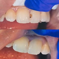 عيادة اصلان • اسنان • تجميل