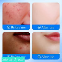 لاصقات • حمض الساليسيليك • تجفيف الحبوب