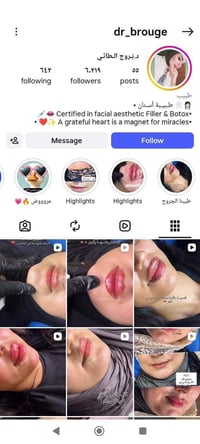 مرحب بنات  دكتور بروج الطائي) وشغلها يجنن ان شالله  راح نسوي معاينه مج...